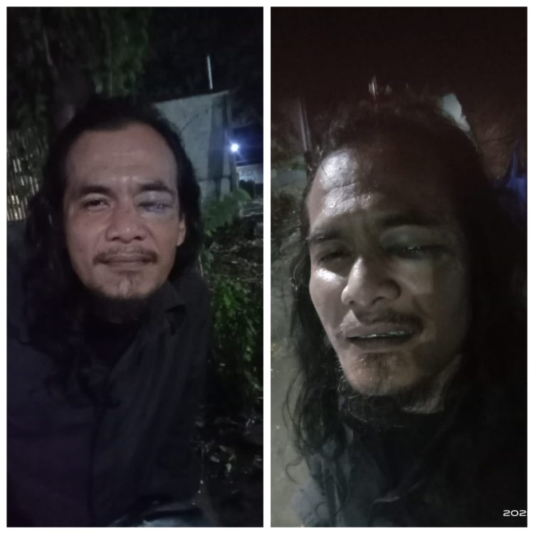 Jurnalis Ambarita Dikeroyok Saat Liputan Dugaan Makanan Kedaluwarsa di Bekasi